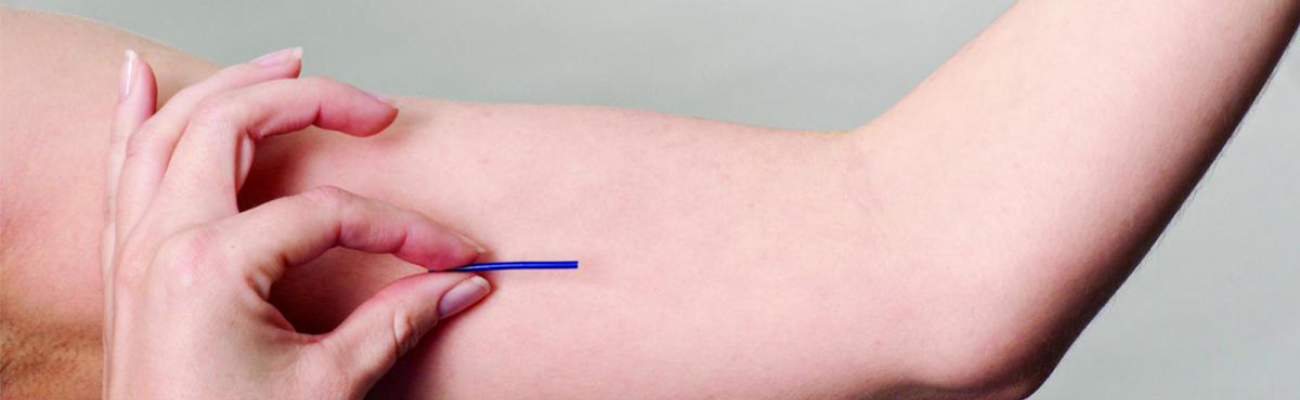 Implantes subdérmicos: Pellets hormonais